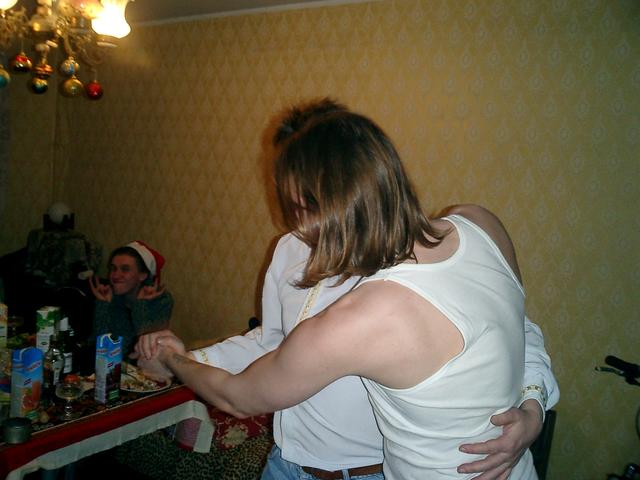 Сиамские близнецы.